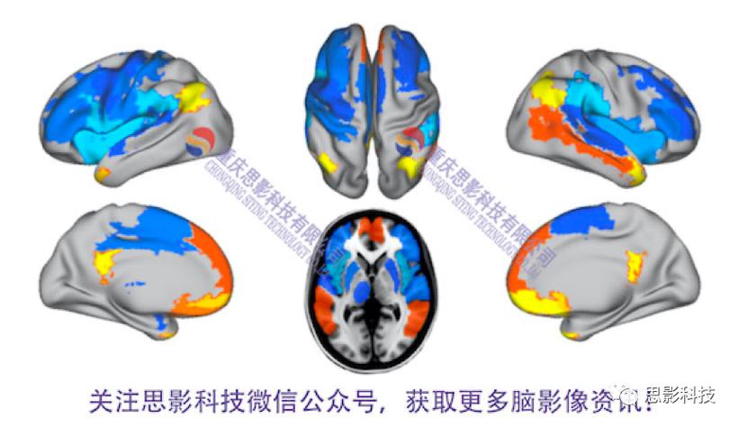 思影科技功能磁共振（fMRI）數(shù)據(jù)處理業(yè)務(wù)全解析